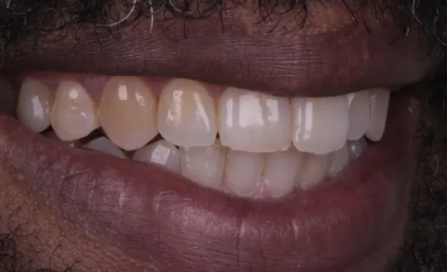 Sorriso antes da transformação 01