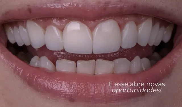Sorriso depois da transformação 03