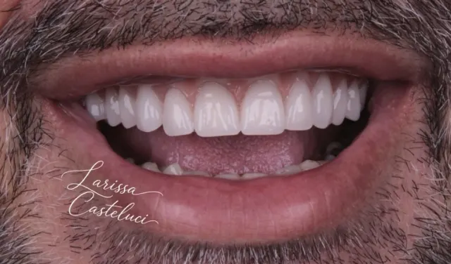 Sorriso depois da transformação 04