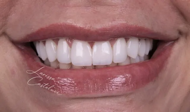 Sorriso depois da transformação 05
