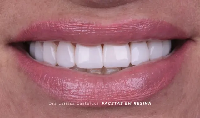 Sorriso depois da transformação 06